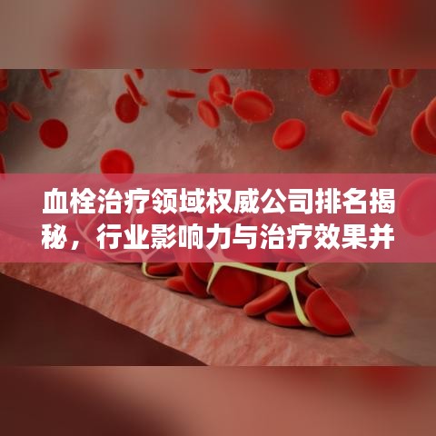 血栓治疗领域权威公司排名揭秘，行业影响力与治疗效果并重