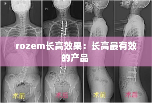 rozem长高效果：长高最有效的产品 